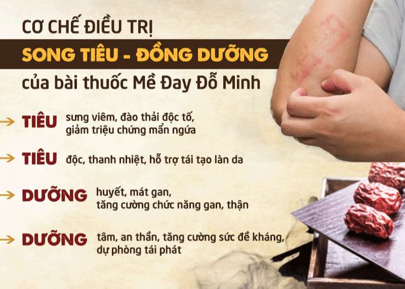 bài thuốc mề đay Đỗ Minh trị dứt điểm mề đay mẩn ngứa