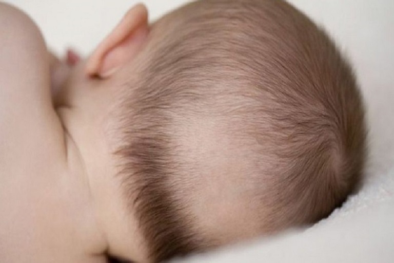 Trẻ trong giai đoạn từ 3- 6 tháng đầu đời thường bị rụng tóc vành khăn