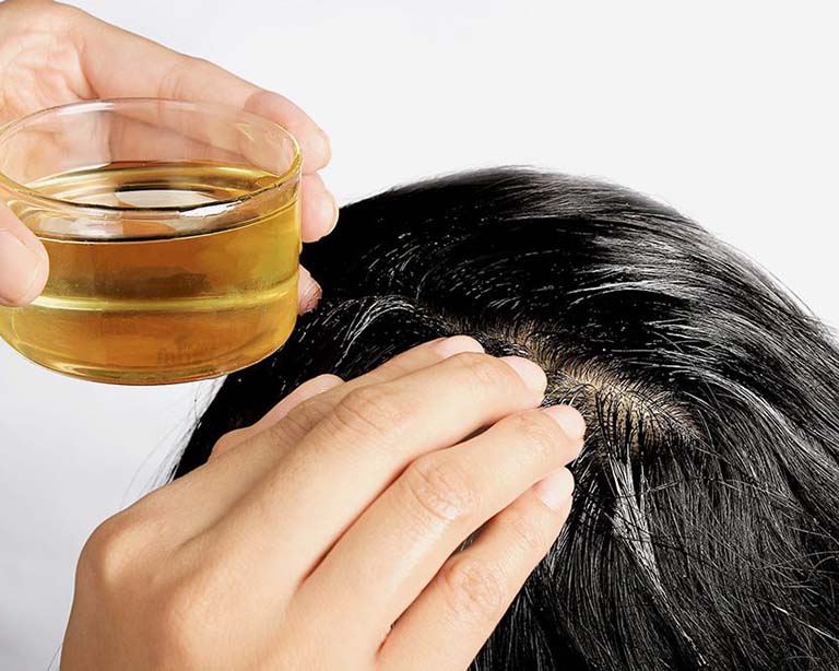 Xịt dầu dừa để ngăn ngừa rụng tóc