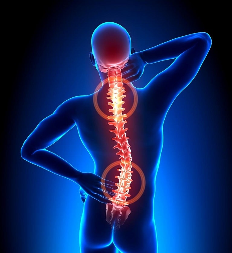Đau dọc sống lưng làm cho người bệnh có cảm giác tê buốt dọc theo vùng xương cột sống