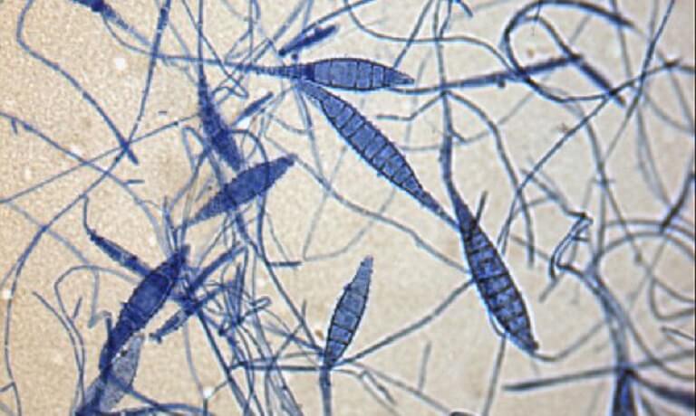 Hình ảnh tế bào nấm hắc lào dưới kính hiển vi