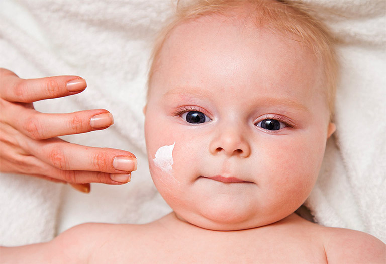 Kem dưỡng ẩm là giải pháp tối ưu dành cho trẻ giúp cải thiện các triệu chứng do bệnh viêm da cơ địa gây ra