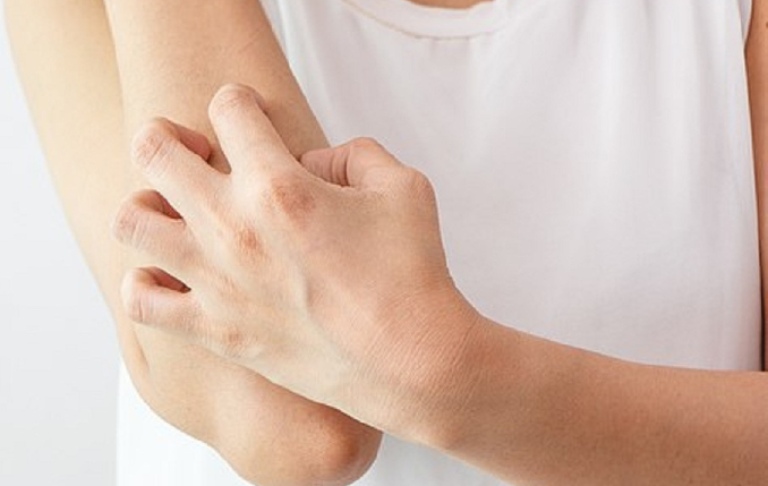 Không dùng tay cào gãi lên vùng da bị tổn thương làm gia tăng nguy cơ nhiễm trùng, bội nhiễm