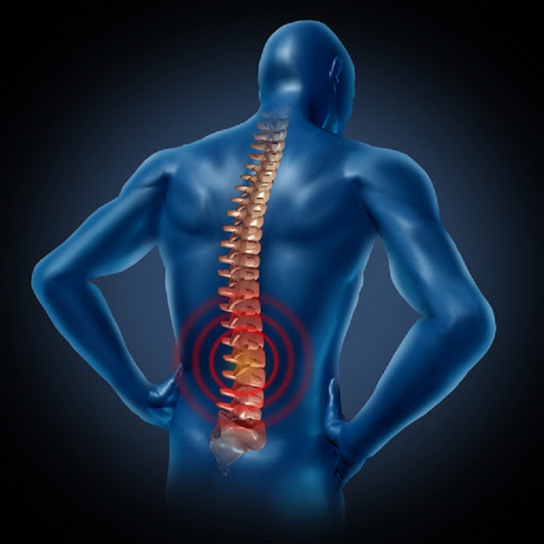 Ngồi quá lâu dẫn tới đau lưng có thể là dấu hiệu của bệnh gai cột sống