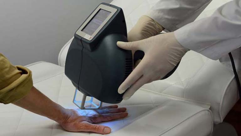 Thực hiện chữa bệnh chàm khô ở đầu ngón tay bằng phương pháp quang trị liệu