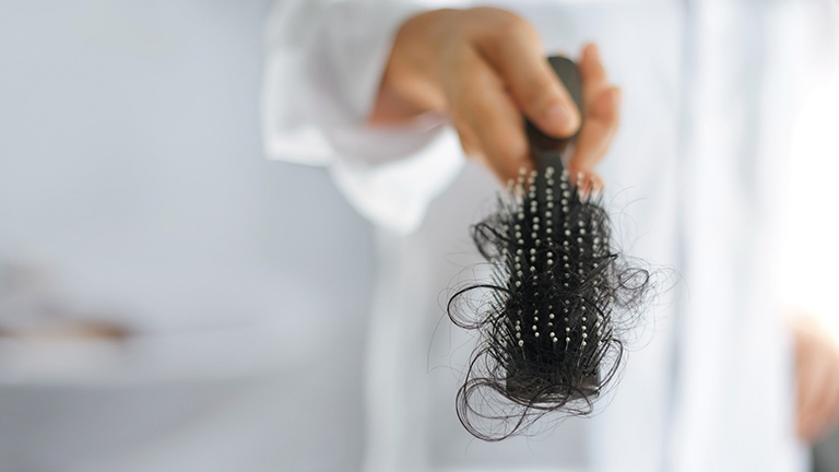 Hình ảnh rụng tóc bất thường trên 100 sợi/ngày
