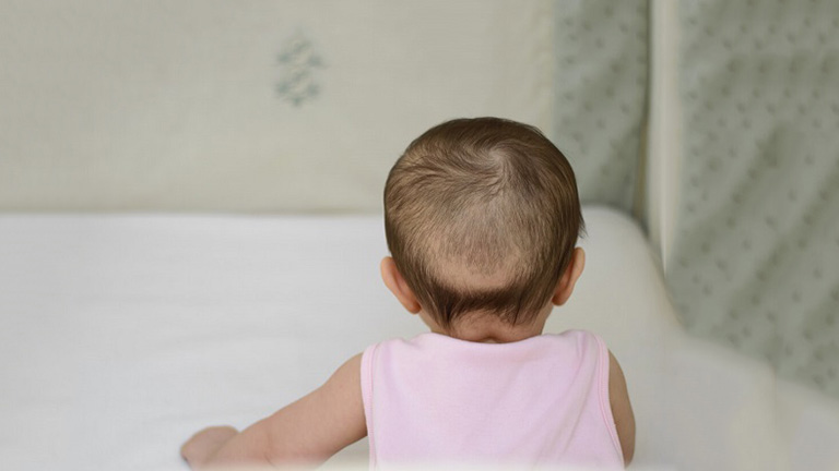 Không nên quá lo lắng khi trẻ sơ sinh bị rụng tóc