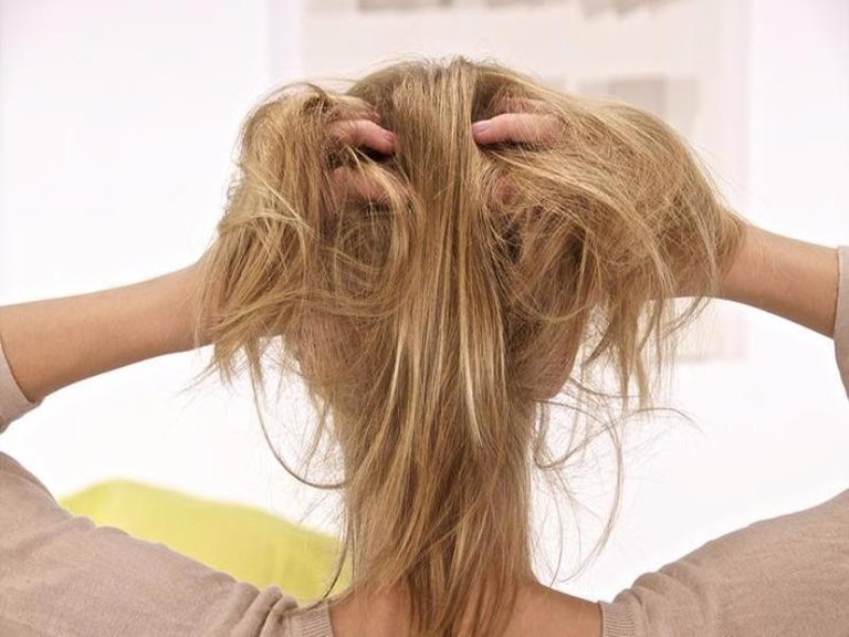 Rụng tóc mùa hè do nhiều nguyên nhân gây ra 