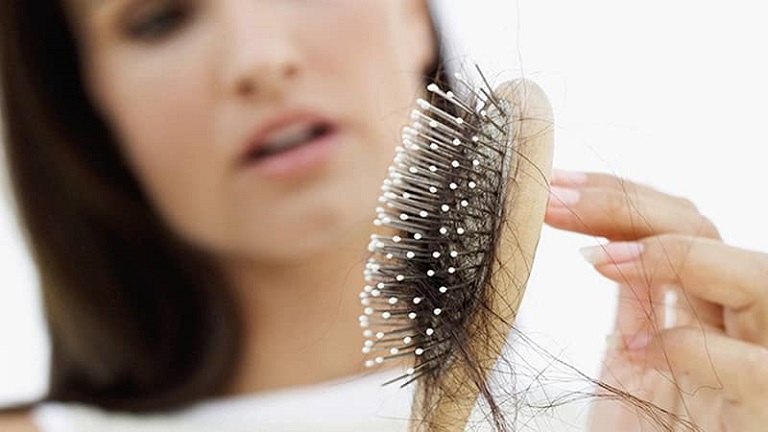 Tóc rụng nhiều ở nữ là một hiện tượng phổ biến hiện nay