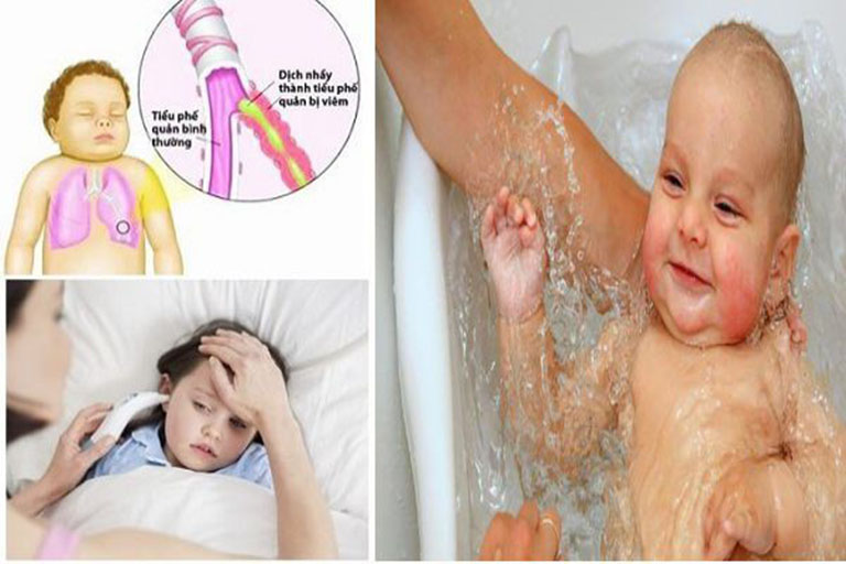 Trẻ bị viêm phế quản có được tắm không? Câu trả lời là có