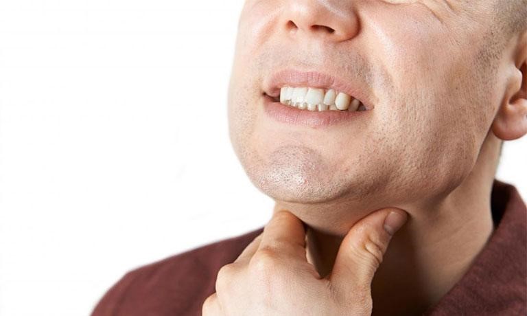 Ho khan, sốt, đau rát cổ họng là triệu chứng điển hình của viêm họng cấp