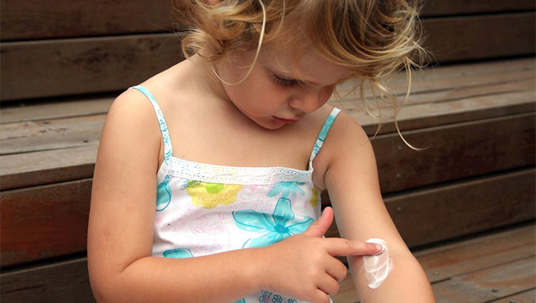 cách chữa bệnh viêm da ở trẻ em